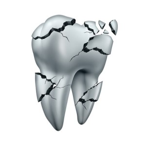 cracked tooth